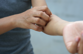 Erupciones en la piel por dermatitis atópica