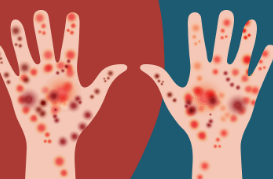 Ilustración de piel con brotes, enrojecimiento y heridas
